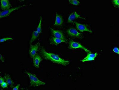 KCNMA1 Antibody