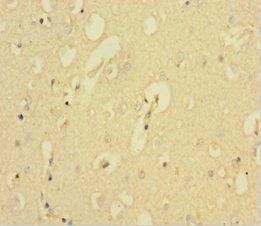 KCNMA1 Antibody