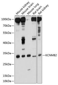 KCNMB2 antibody