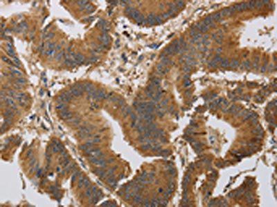 KCNMB4 Antibody