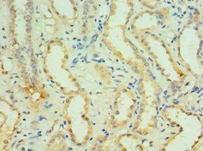 KCNN4 Antibody