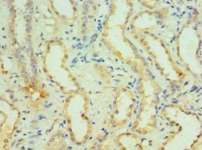 KCNN4 antibody