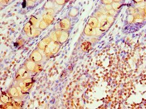 KCNN4 Antibody