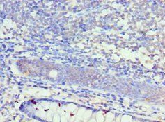 KCNN4 Antibody