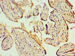 KCNN4 Antibody