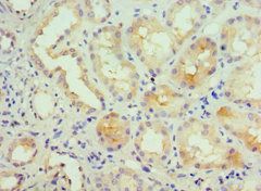 KCNN4 Antibody