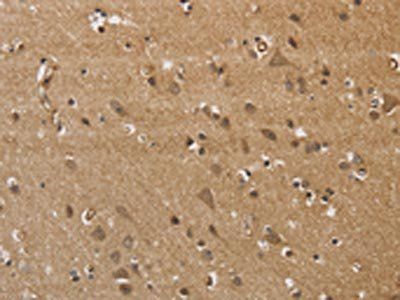 KCNN4 Antibody