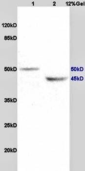 KCNN4 antibody