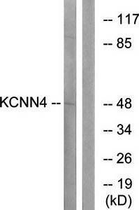 KCNN4 Antibody