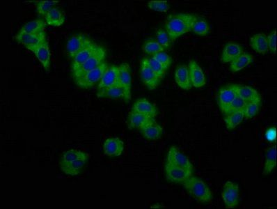 KCNT1 Antibody