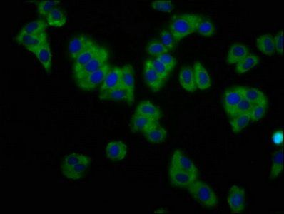 KCNT1 antibody