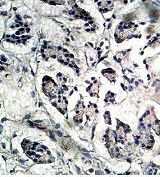 KCNV2 Rabbit Polyclonal Antibody