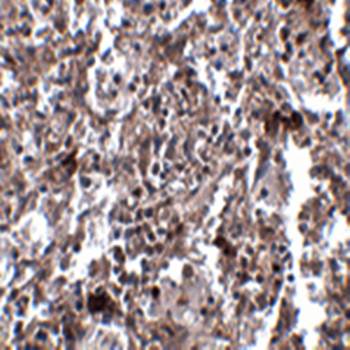 KCTD15 Antibody