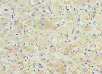 KCTD19 Antibody