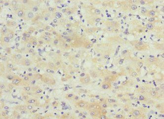 KCTD19 antibody