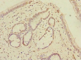 KCTD6 Antibody