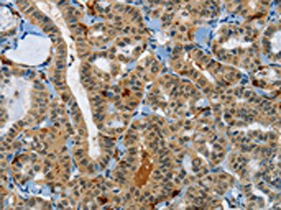 KDM1A Antibody