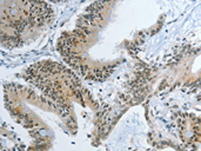 KDM1A Antibody