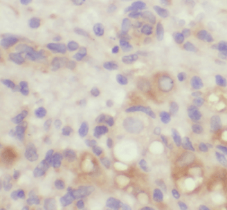 KDM3A,JMJD1A antibody