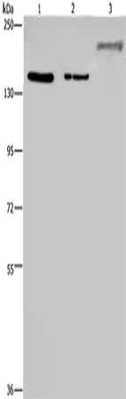 KDM3B antibody