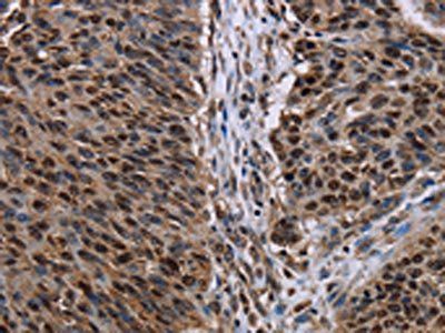 KDM3B Antibody
