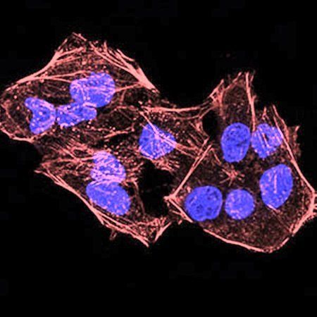 KDM4A Antibody