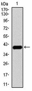 KDM4A Antibody