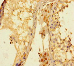 KDM4A Antibody