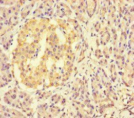 KDM4C Antibody