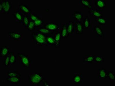 KDM6B Antibody