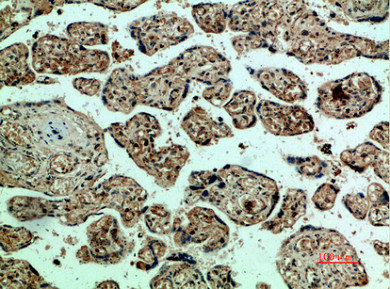 KDR Antibody