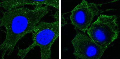 KDR Antibody