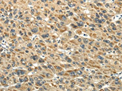 KEAP1 Antibody