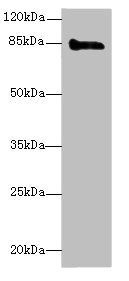 KEL antibody