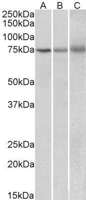 Goat anti-KLHL6 / Kelch-like 6 Antibody