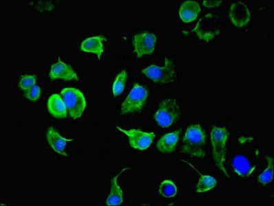 Keratin, type I cytoskeletal 10 antibody