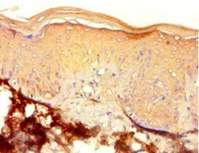 Keratin, type I cytoskeletal 10 antibody