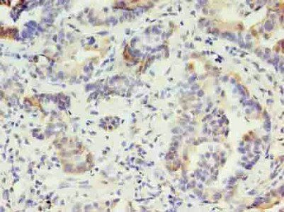 KRT10 Antibody