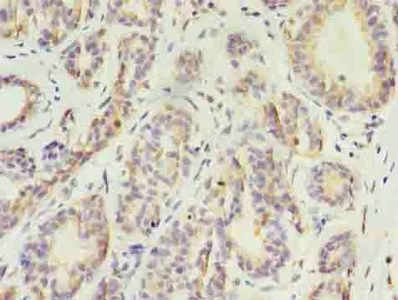 KRT10 Antibody