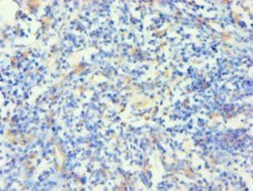 KRT14 Antibody