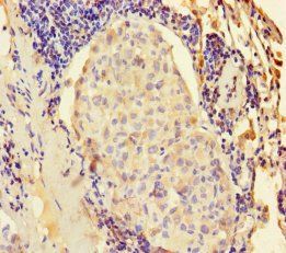 KRT6A Antibody
