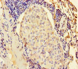 Keratin, type II cytoskeletal 6A antibody