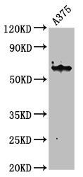 Keratin, type II cytoskeletal 6A antibody