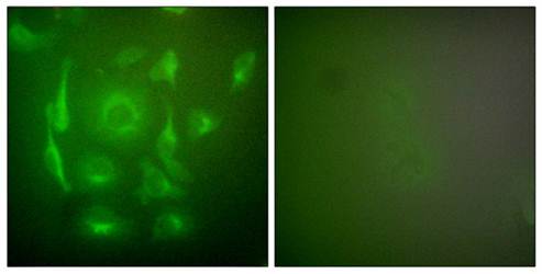 Keratin 7 Antibody