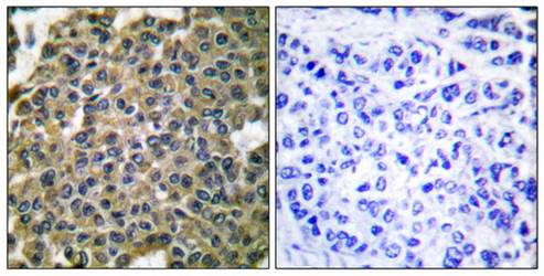 Keratin 7 Antibody