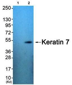 Keratin 7 antibody