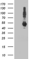 ketohexokinase Antibody