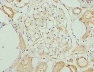 KHDRBS3 Antibody