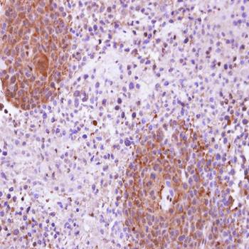 KHS Rabbit Polyclonal Antibody