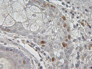Ki-67, Cell Cycle Marker (MIB-1) Antibody